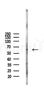 CDR2 Antibody - Western blot analysis of lysates from B16F10-LUC cells(heat-shock 45min treatment), using CDR2 Antibody at 1/1000 dilution.