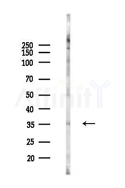CRX Antibody - Western blot analysis of lysates from HUVEC cells(heat-shock 45min treatment), using CRX Antibody at 1/1000 dilution.