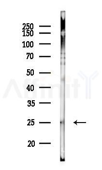 Cytoglobin Antibody - Western blot analysis of lysates from K562 cells(UV 30min treatment), using Cytoglobin Antibody at 1/1000 dilution.