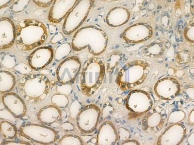 DDX6 Antibody - DF12937 at 1/100 staining human normal kidney tissue by IHC-P.