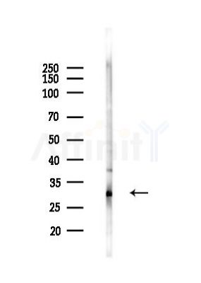 ECH1 Antibody - Western blot analysis of lysates from HUVEC cells(heat-shock 45min treatment), using ECH1 Antibody at 1/1000 dilution.