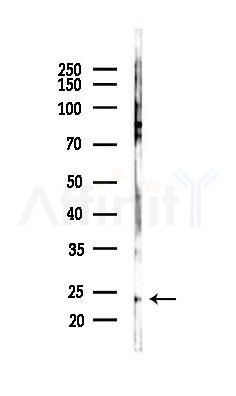 HOXB7 Antibody - Western blot analysis of lysates from COLO205 cells(starvation 24h treatment), using HOXB7 Antibody at 1/1000 dilution.