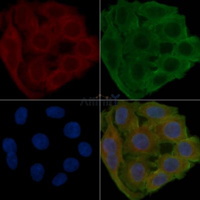 ALDH1L1 Antibody - DF13229 staining Hela cells(24h of starvation treatment) by IF/ICC.