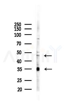 LOX Antibody - Western blot analysis of lysates from K562 cells(UV 30min treatment), using LOX Antibody at 1/1000 dilution.