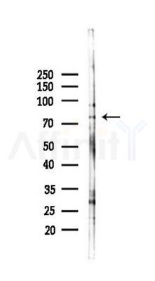 Retinoid X Receptor beta Antibody - Western blot analysis of lysates from K562 cells(heat-shock 45min treatment), using Retinoid X Receptor beta Antibody at 1/1000 dilution.