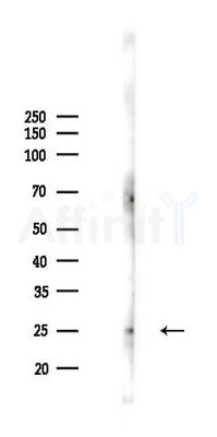 Rab4 Antibody - Western blot analysis of lysates from A2780 cells(LPS 4h treatment), using Rab4 Antibody at 1/1000 dilution.