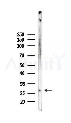 APH1a Antibody - Western blot analysis of lysates from K562 cells(heat-shock 45min treatment), using APH1a Antibody at 1/1000 dilution.