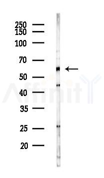 Tip60 Antibody - Western blot analysis of lysates from K562 cells(UV 30min treatment), using Tip60 Antibody at 1/1000 dilution.