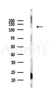 CRM1 Antibody - Western blot analysis of lysates from Rat lung, using CRM1 Antibody at 1/1000 dilution.
