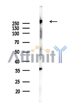 PAPP A2 Antibody - Western blot analysis of extracts from rat brain tissue, using PAPP A2 Antibody.
