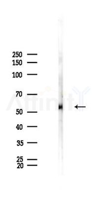 TEM8 Antibody - Western blot analysis of lysates from Rat brain, using TEM8 Antibody at 1/1000 dilution.