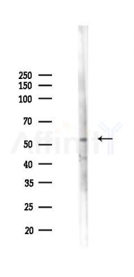 TEM8 Antibody - Western blot analysis of lysates from A2780 cells(LPS 4h treatment), using TEM8 Antibody at 1/1000 dilution.