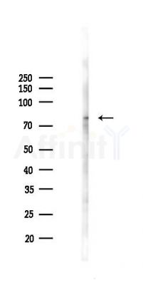 COMP Antibody - Western blot analysis of lysates from A2780 cells(LPS 4h treatment), using COMP Antibody at 1/1000 dilution.