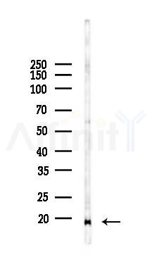 RPA14 Antibody - Western blot analysis of lysates from K562 cells(UV 30min treatment), using RPA14 Antibody at 1/1000 dilution.
