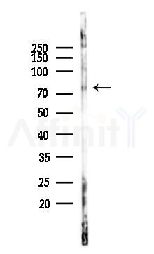 15 Lipoxygenase 1 Antibody - Western blot analysis of lysates from Rat liver, using 15 Lipoxygenase 1 Antibody at 1/1000 dilution.