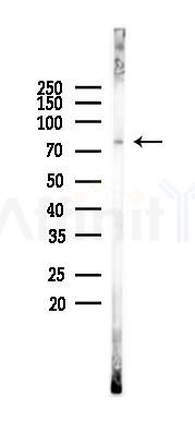 15 Lipoxygenase 1 Antibody - Western blot analysis of lysates from Mouse lung, using 15 Lipoxygenase 1 Antibody at 1/1000 dilution.