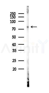 15 Lipoxygenase 1 Antibody - Western blot analysis of lysates from K562 cells(UV 30min treatment), using 15 Lipoxygenase 1 Antibody at 1/1000 dilution.