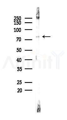 15 Lipoxygenase 1 Antibody - Western blot analysis of lysates from RAW264.