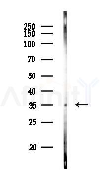MAPRE1 Antibody - Western blot analysis of lysates from K562 cells(UV 30min treatment), using MAPRE1 Antibody at 1/1000 dilution.