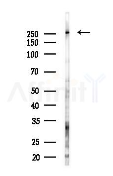 KCC2 Antibody - Western blot analysis of lysates from Hela cells(starvation 24h treatment), using KCC2 Antibody at 1/1000 dilution.
