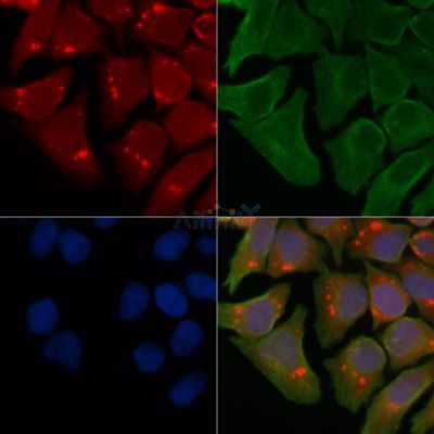 Nogo Receptor Antibody - DF13593 staining Hela cells(45min of heat-shock treatment) by IF/ICC.