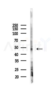 GABA A receptor pi Antibody - Western blot analysis of lysates from K562 cells(UV 30min treatment), using GABA A receptor pi Antibody at 1/1000 dilution.