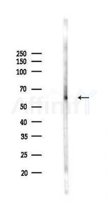 IL21 Receptor Antibody - Western blot analysis of lysates from A2780 cells(LPS 4h treatment), using IL21 Receptor Antibody at 1/1000 dilution.