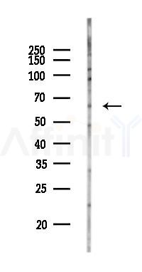 COL10A1 Antibody - Western blot analysis of lysates from K562 cells(UV 30min treatment), using COL10A1 Antibody at 1/1000 dilution.