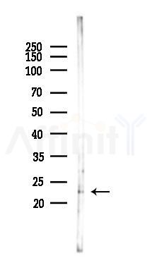 IL23 Antibody - Western blot analysis of lysates from Rat liver, using IL23 Antibody at 1/1000 dilution.