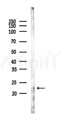 IL23 Antibody - Western blot analysis of lysates from K562 cells(UV 30min treatment), using IL23 Antibody at 1/1000 dilution.