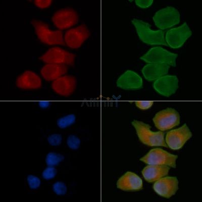 ADAMTS15 Antibody - DF13780 staining Hela cells(45min of heat-shock treatment) by IF/ICC.