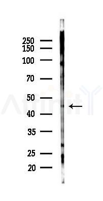 SFRP4 Antibody - Western blot analysis of lysates from COLO205 cells(starvation 24h treatment), using SFRP4 Antibody at 1/1000 dilution.