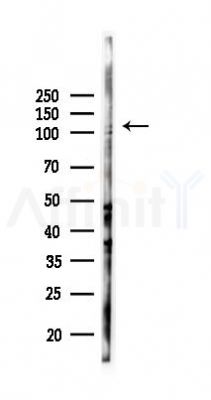 KCNH5 Antibody - Western blot analysis of lysates from K562 cells(UV 30min treatment), using KCNH5 Antibody at 1/1000 dilution.