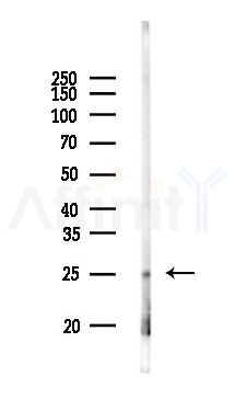 IL29 Antibody - Western blot analysis of lysates from Rat lung, using IL29 Antibody at 1/1000 dilution.