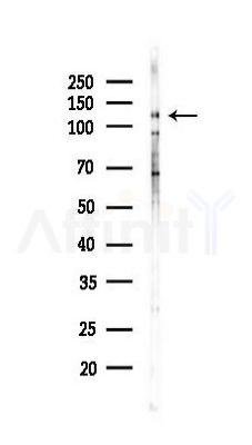 SND1 Antibody - Western blot analysis of lysates from COLO205 cells(UV 30min treatment), using SND1 Antibody at 1/1000 dilution.