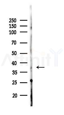 TFB2M Antibody - Western blot analysis of lysates from K562 cells(UV 30min treatment), using TFB2M Antibody at 1/1000 dilution.