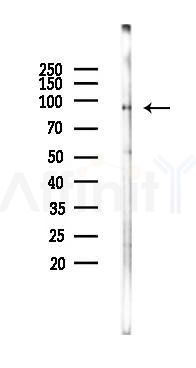 GPAM Antibody - Western blot analysis of lysates from Rat brain, using GPAM Antibody at 1/1000 dilution.