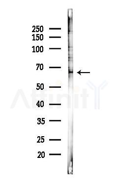 ZNF350 Antibody - Western blot analysis of lysates from Hela cells(starvation 24h treatment), using ZNF350 Antibody at 1/1000 dilution.