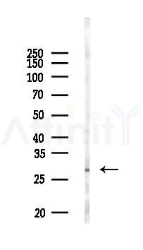IL17D Antibody - Western blot analysis of lysates from Rat lung, using IL17D Antibody at 1/1000 dilution.