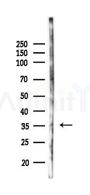 ZNF364 Antibody - Western blot analysis of lysates from K562 cells(UV 30min treatment), using ZNF364 Antibody at 1/1000 dilution.