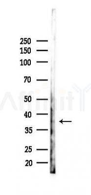 Syntenin 2 Antibody - Western blot analysis of lysates from RAW264.