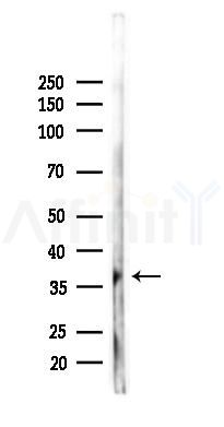 ZWINT Antibody - Western blot analysis of lysates from RAW264.