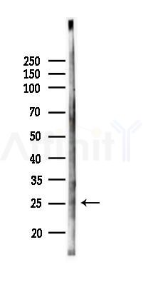RBM24 Antibody - Western blot analysis of lysates from K562 cells(UV 30min treatment), using RBM24 Antibody at 1/1000 dilution.