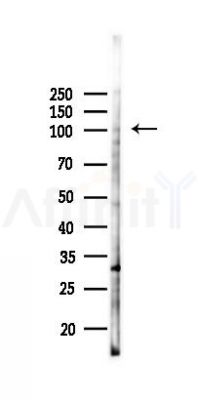 RRBP1 Antibody - Western blot analysis of lysates from K562 cells(UV 30min treatment), using RRBP1 Antibody at 1/1000 dilution.