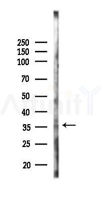 PRPS2 Antibody - Western blot analysis of lysates from K562 cells(UV 30min treatment), using PRPS2 Antibody at 1/1000 dilution.