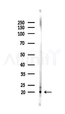 p19 INK4d Antibody - Western blot analysis of lysates from Mouse liver, using p19 INK4d Antibody at 1/1000 dilution.