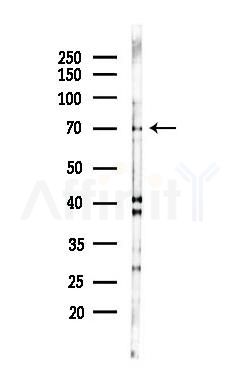 DLL3 Antibody - Western blot analysis of lysates from Hela cells(starvation 24h treatment), using DLL3 Antibody at 1/1000 dilution.