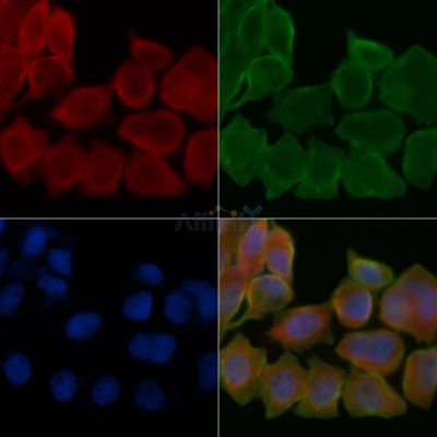 YTHDF3 Antibody - DF13863 staining Hela cells(45min of heat-shock treatment) by IF/ICC.