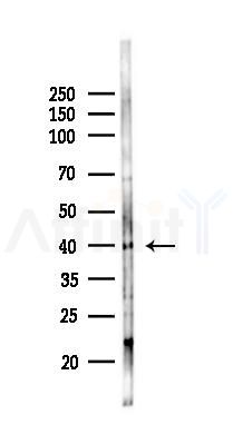 PAF Receptor Antibody - Western blot analysis of lysates from K562 cells(UV 30min treatment), using PAF Receptor Antibody at 1/1000 dilution.