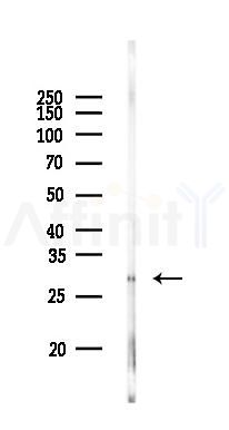 PPAPDC3 Antibody - Western blot analysis of lysates from Rat lung, using PPAPDC3 Antibody at 1/1000 dilution.